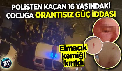 Polisten kaçan 16 yaşındaki çocuğa orantısız güç iddası