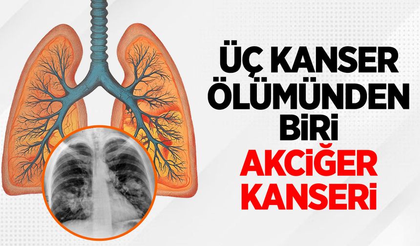 Her 3 Kanser Ölümünden Biri Akciğer Kanseri