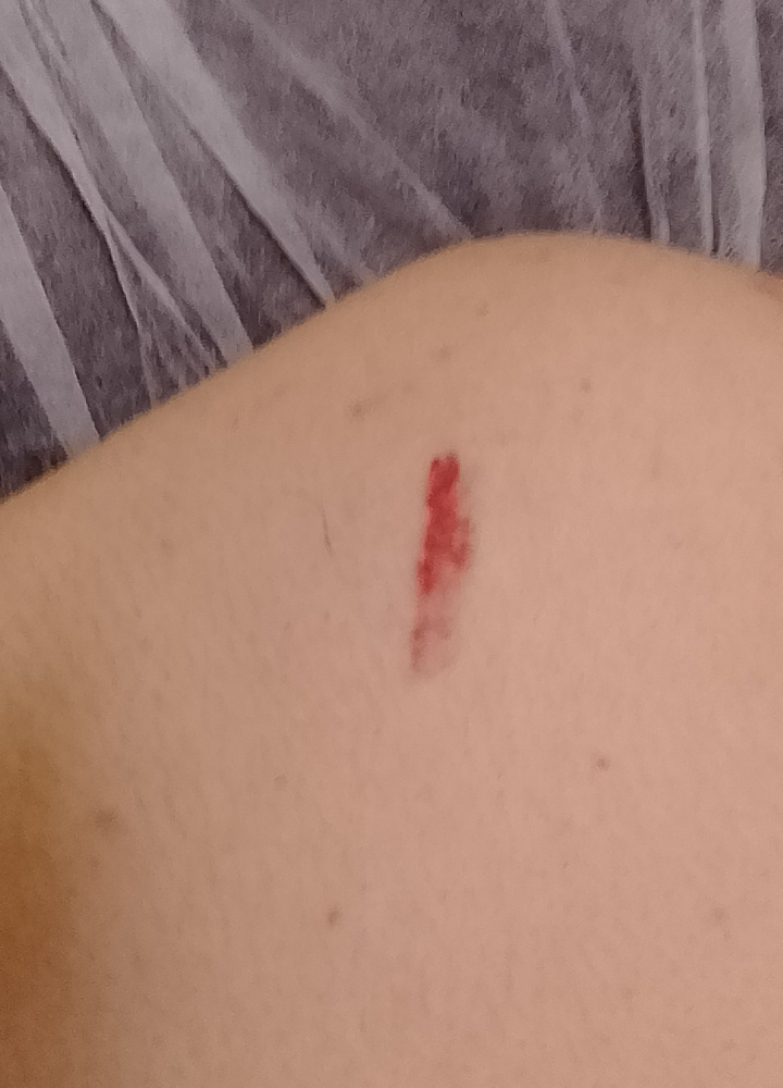 B O Z U Y U K 039 T E 16 Y A S I N D A K I C O C U G A O R A N T I S I Z G U C I D D A S I 5964