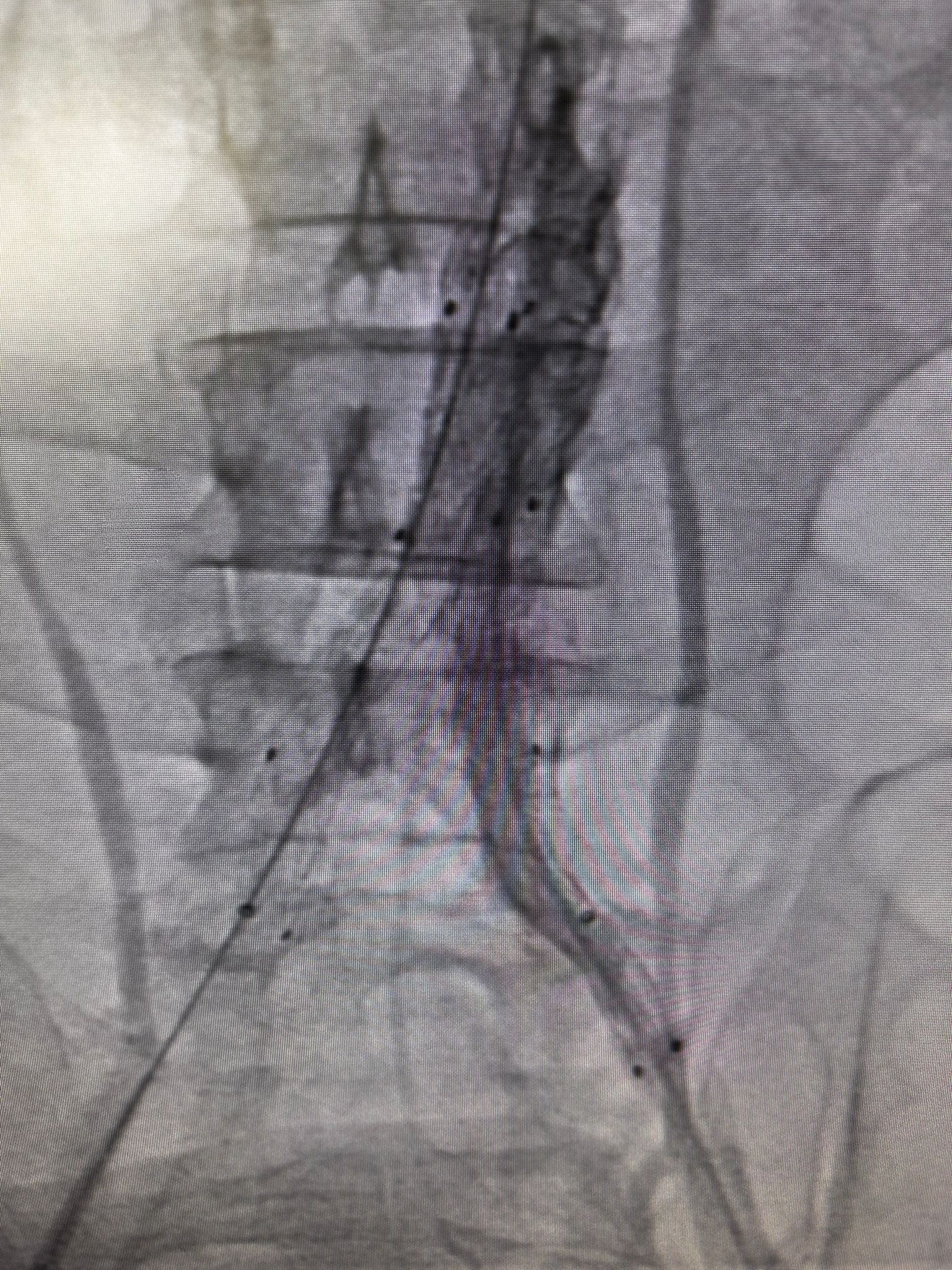 Bilecik’te Hayat Kurtaran Müdahale 8544